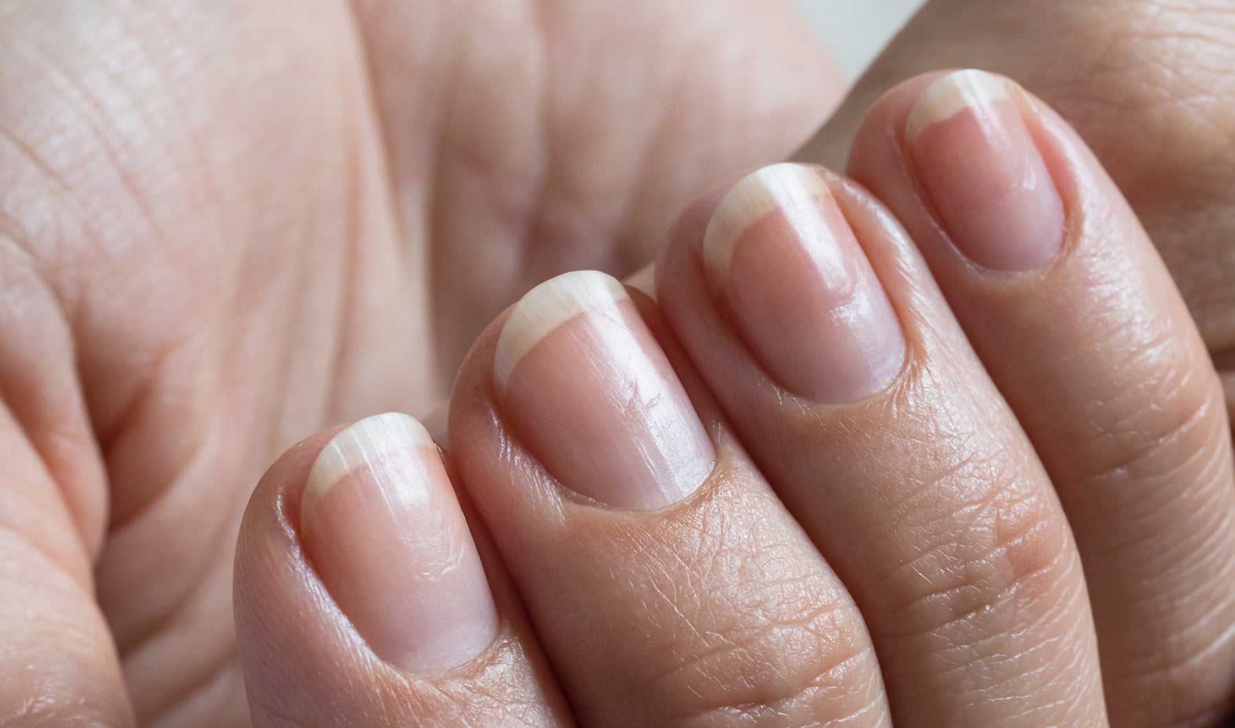 Vertical Ridges on Nails: Is It a Vitamin Deficiency? – Terranics